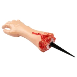 Avhogd Arm i Bakken